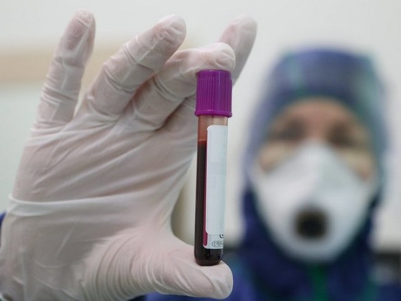 В России за сутки число случаев коронавируса подскочило более чем на 22 тысячи