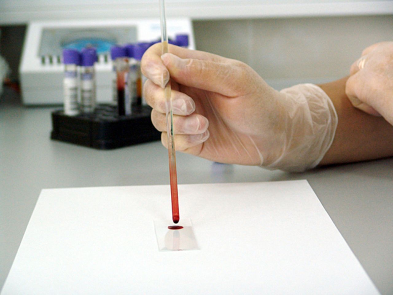 Почему кровь на анализ берут из безымянного пальца