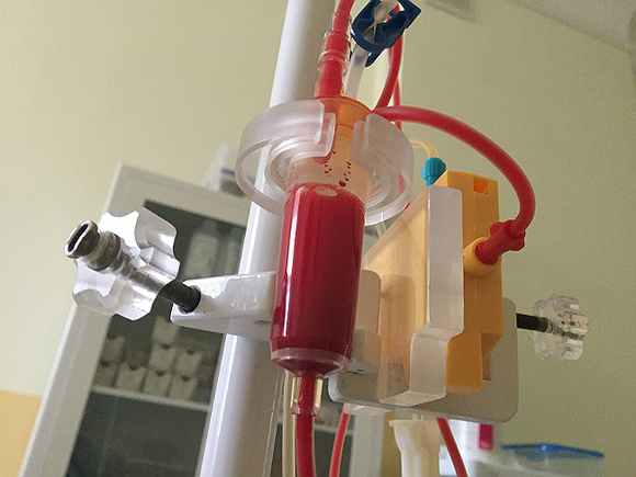 Петербургские больницы столкнулись с дефицитом крови